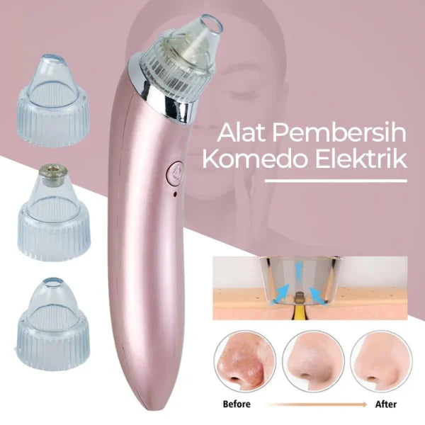 Face Vacuum Blackhead Remover Pore Cleaner